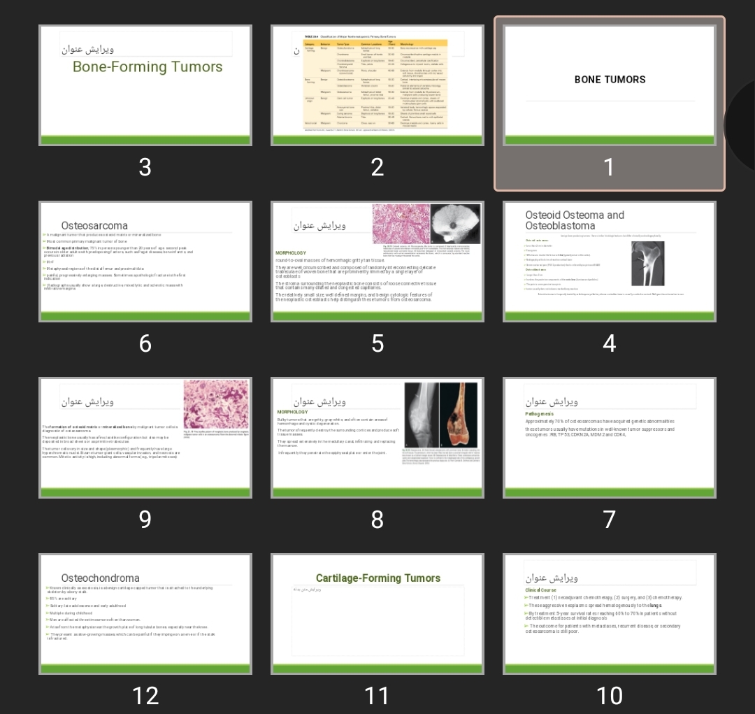 پاورپوینت BONE TUMORS