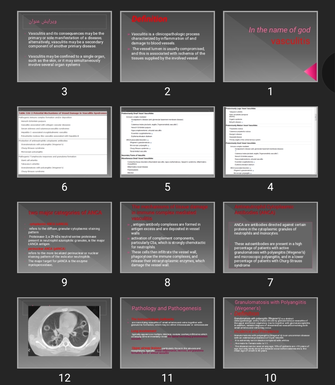 پاورپوینت vasculitis وسکولیت
