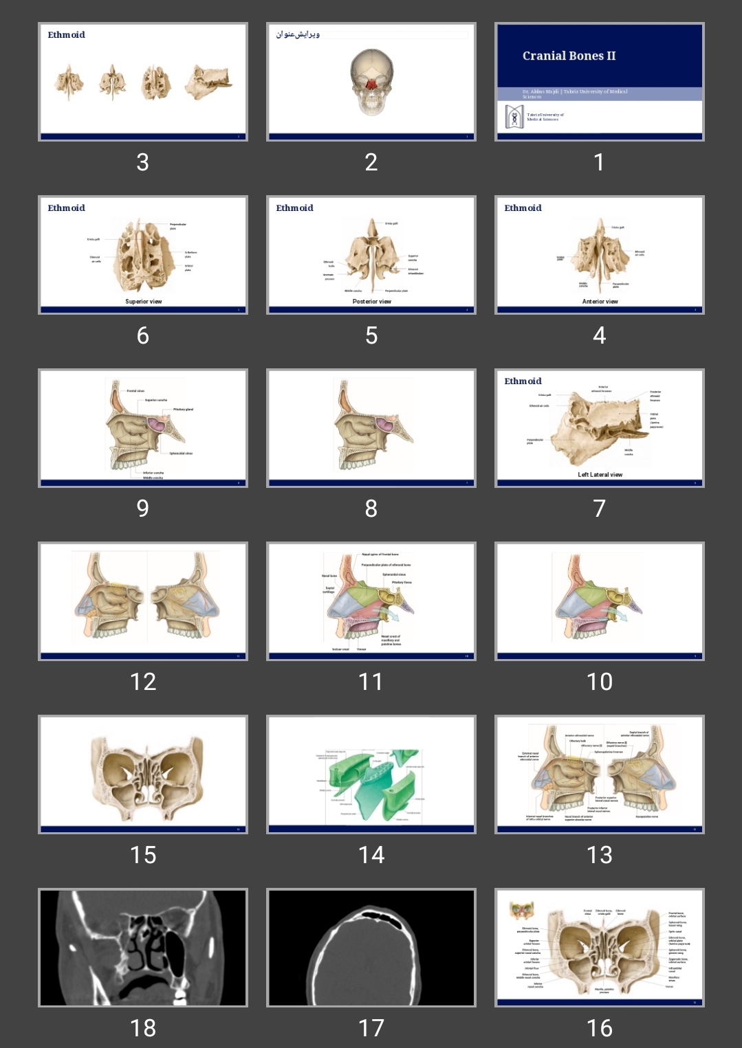 پاورپوینت Cranial Bones II