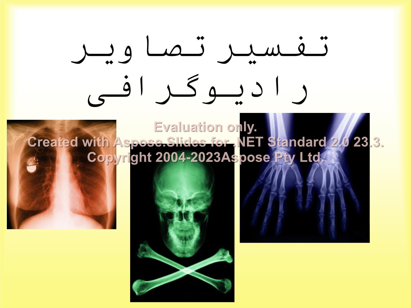 پاورپوینت تفسیر تصاویر رادیوگرافی      تعداد اسلاید : 214      نسخه کامل✅