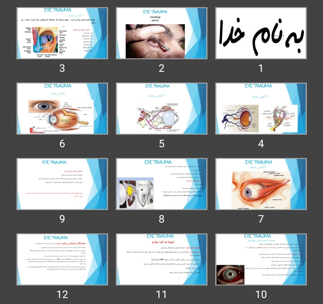 پاورپوینت EYE TRAUMA