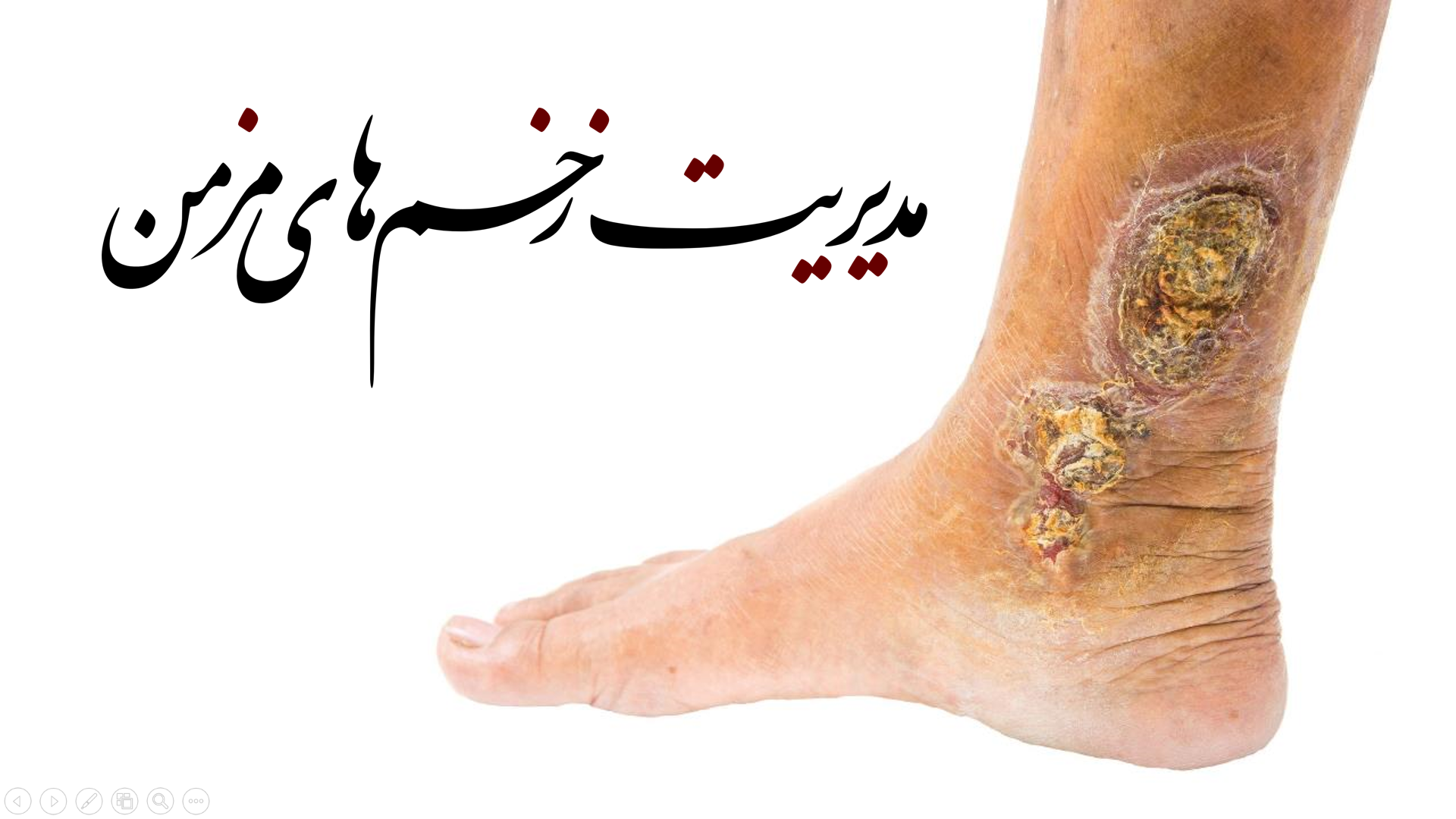 پاورپوینت فصل ترمیم زخم لارنس ۲۰۱۹