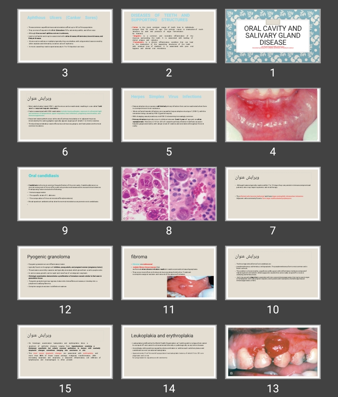 پاورپوینت Oral cavity and salivary gland disease