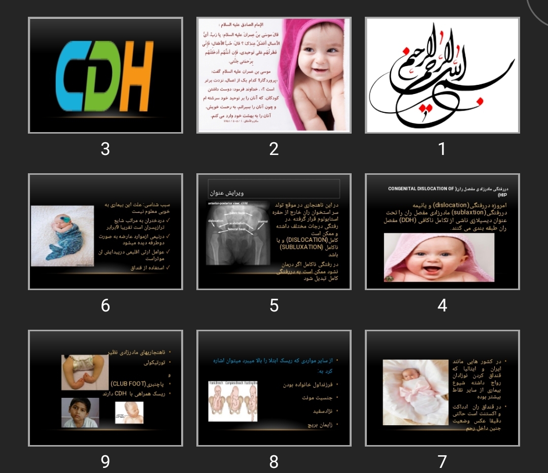 پاورپوینت دررفتگی مادرزادی مفصل ران CDH (congenital dislocation of hip)