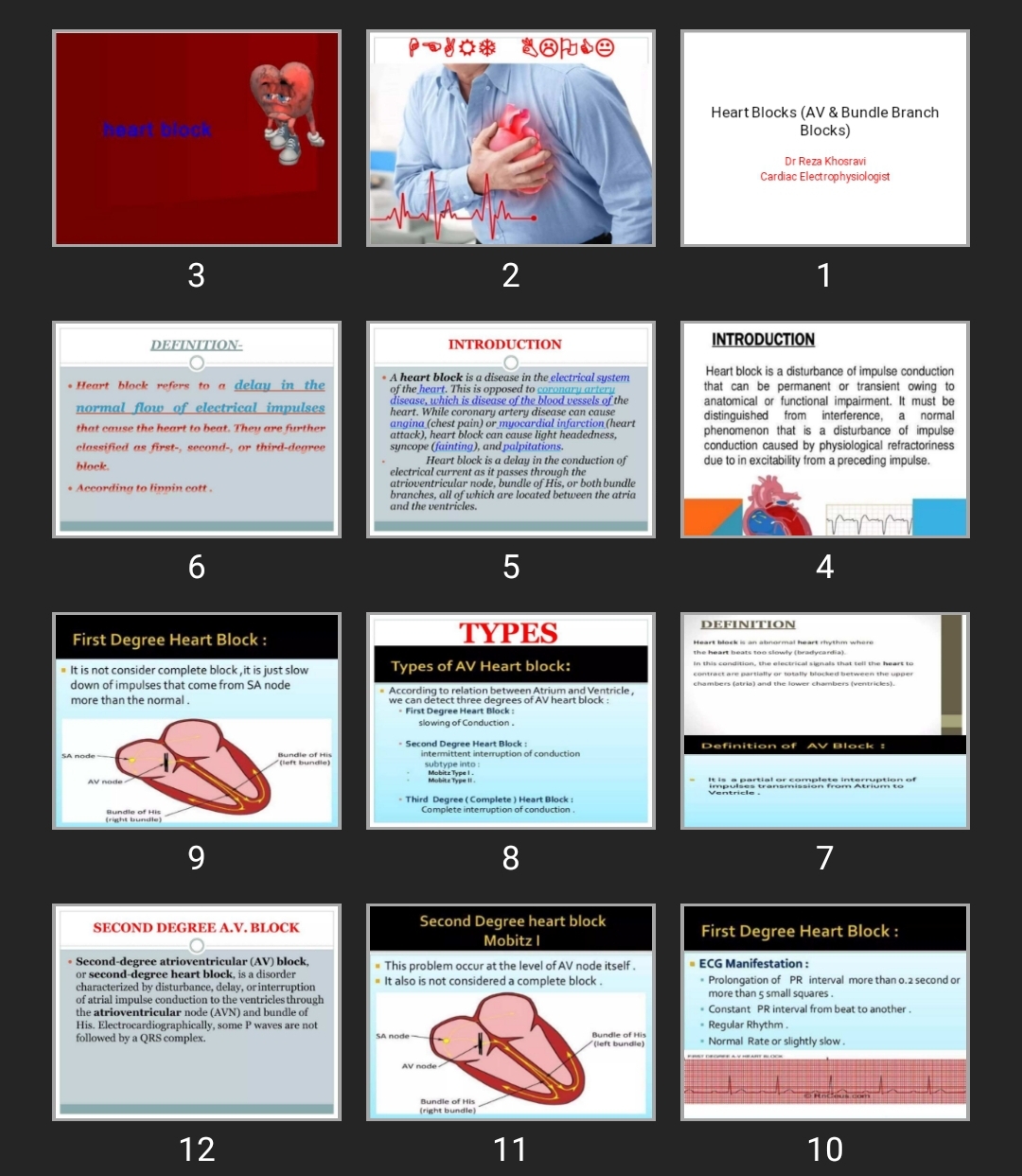 پاورپوینت Heart Blocks (AV & Bundle Branch Blocks)