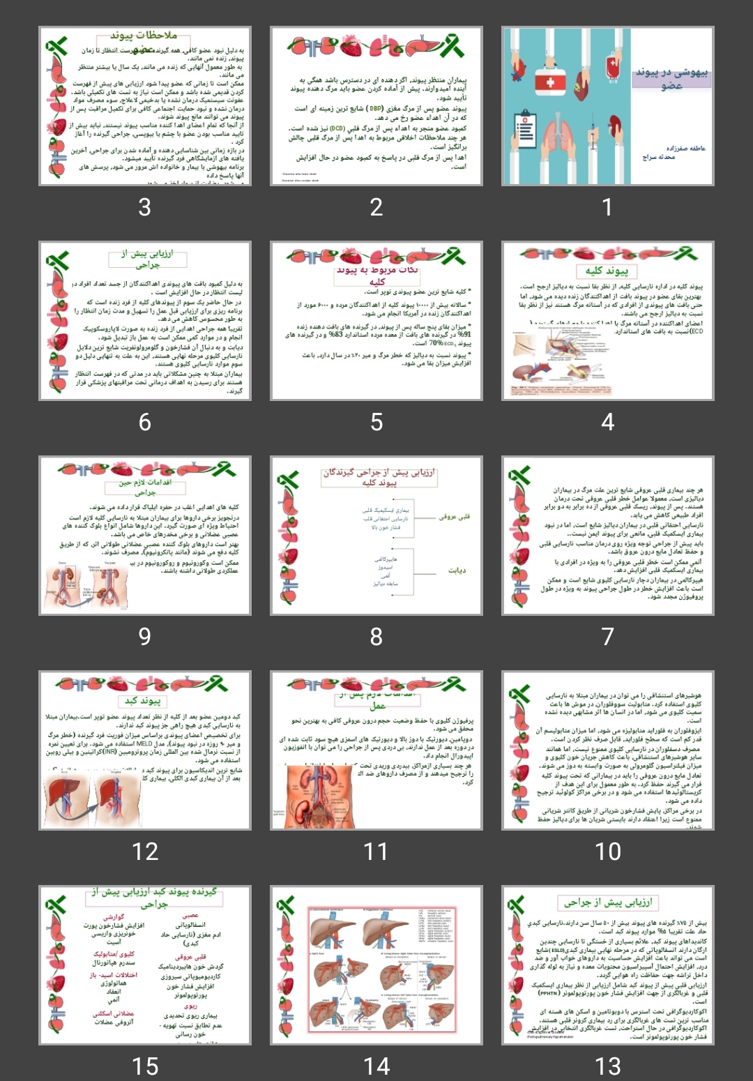 پاورپوینت بیهوشی در پیوند عضو