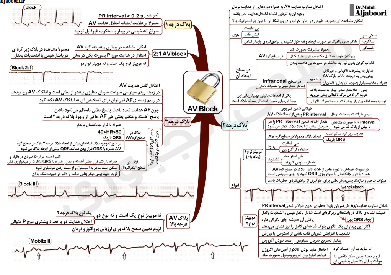 آریتمی های قلبی از سیسیل ۲۰۱۶ (به روش نقشه ذهنی) فوق حرفه ای