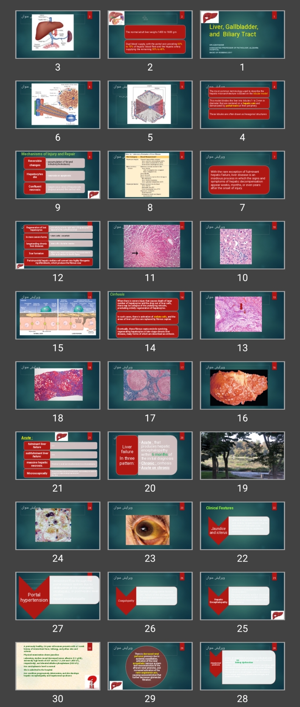 پاورپوینت Liver, Gallbladder, and Biliary Tract