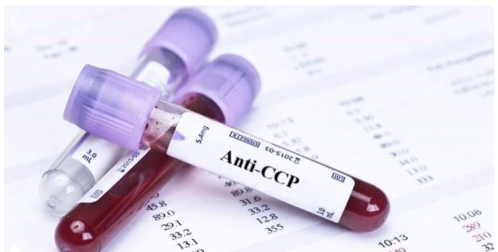 جزوه آموزشی تفسیر تست های ANTI CCP – RF – CRP ویژه کارشناسان آزمایشگاه، پزشکان و پیراپزشکان