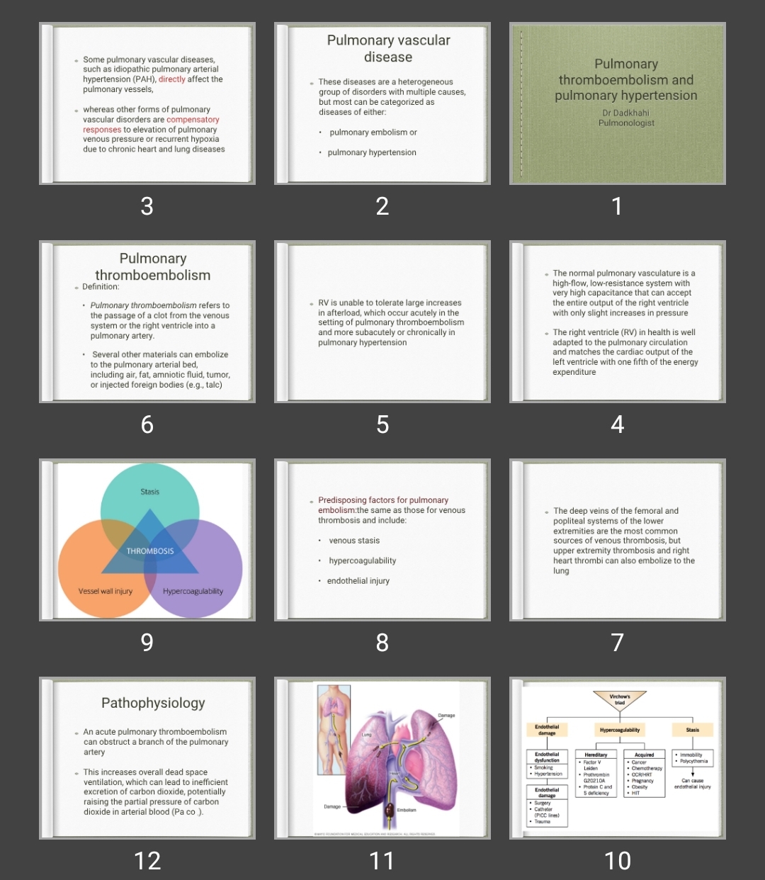 پاورپوینت هایپرتنشن و امبولی ریوی Pulmonary thromboembolism and pulmonary hypertension