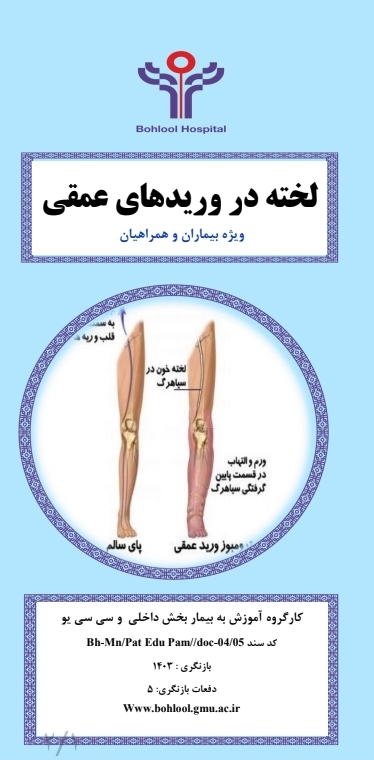 پمفلت لخته در وریدهای عمقی