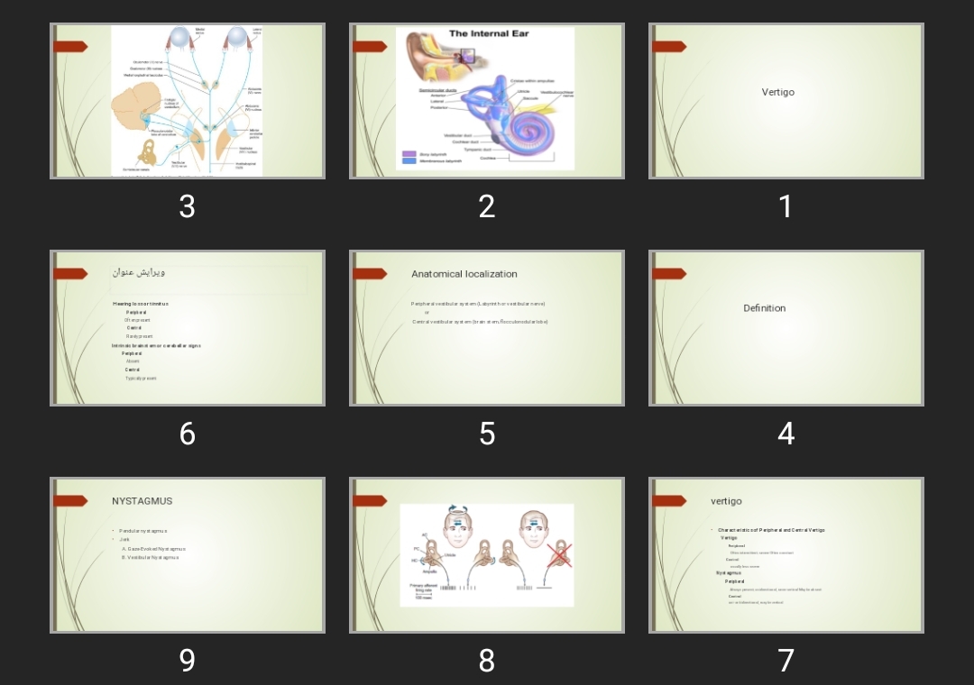 پاورپوینت Vertigo