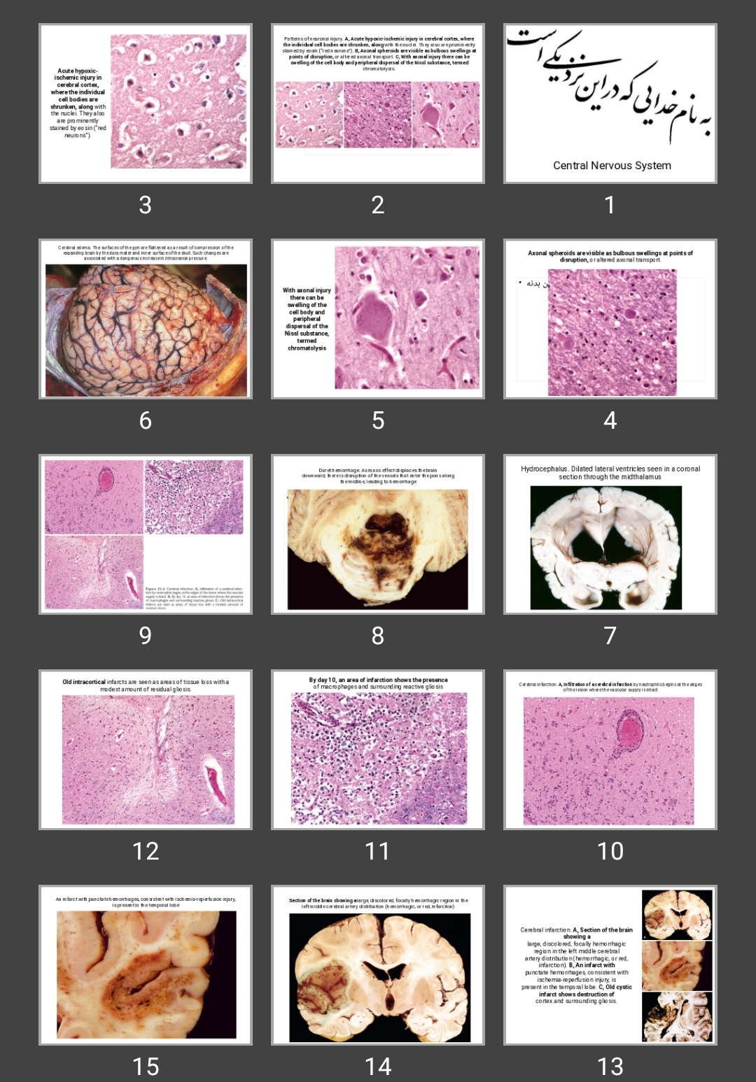 پاورپوینت Central Nervous System