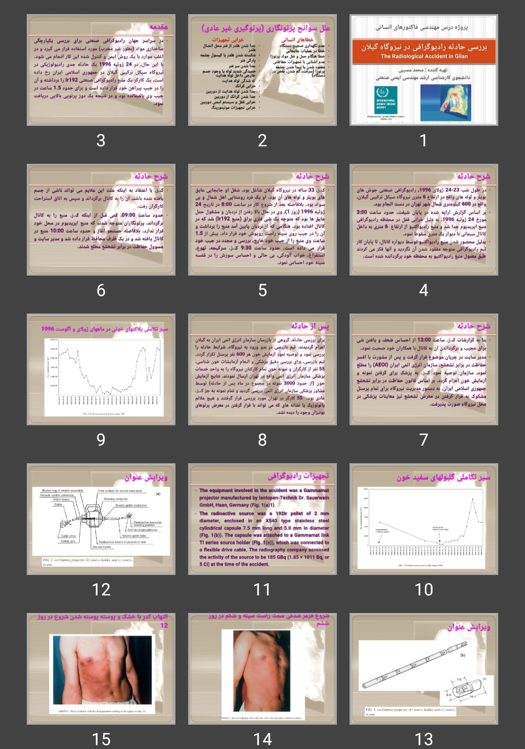 پاورپوینت بررسی حادثه رادیوگرافی در نیروگاه گیلانThe Radiological Accident in Gilan