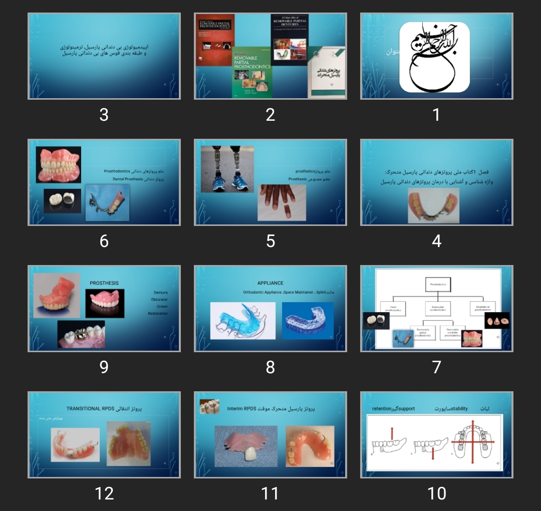 پاورپوینت  ترمینولوژی پروتزهای دندانی و قالب‌گیری اولیه در پروتزهای پارسیل