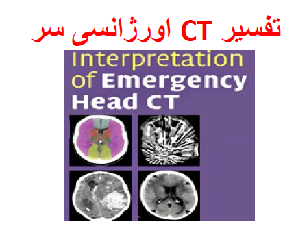 تفسیر CT Scan سر