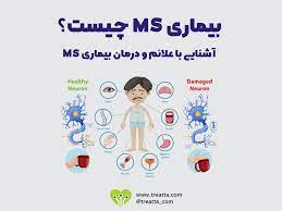 تحقیق آماده برای بیماری ام اس MS