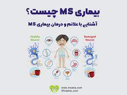 تحقیق آماده برای بیماری ام اس MS