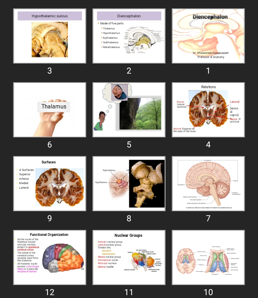 پاورپوینت Diencephalon