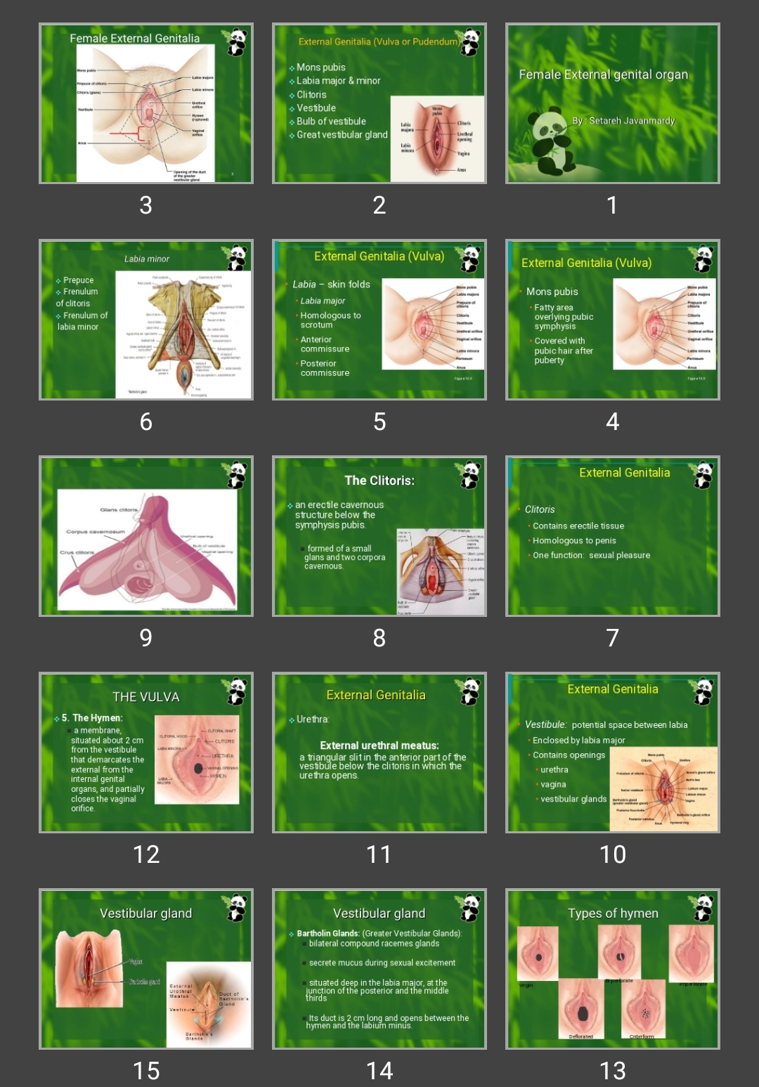 پاورپوینت Female External genital organ