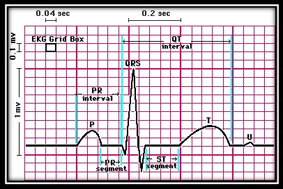 بسته آموزشی خواندن نوار قلب در 30 ثانیه