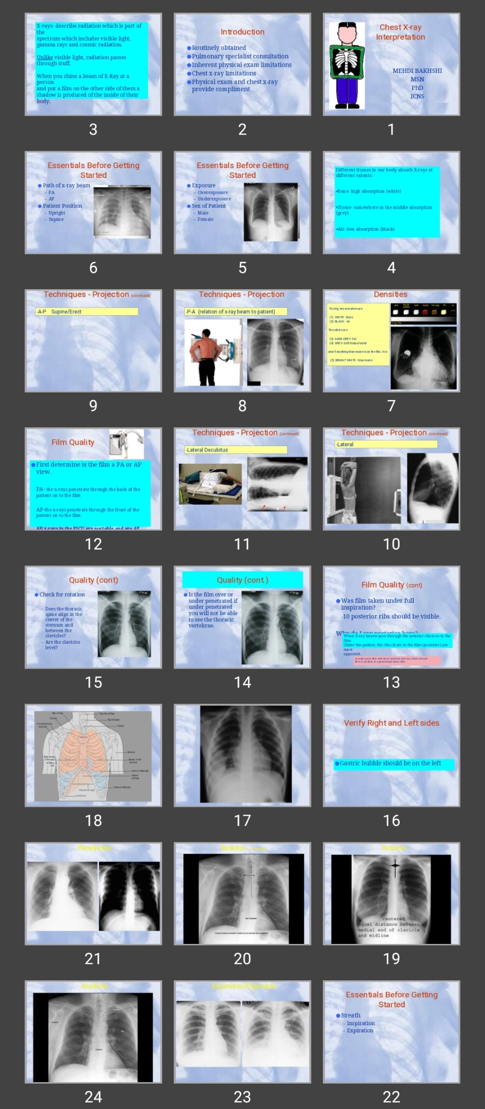 پاورپوینت Chest X-ray Interpretation