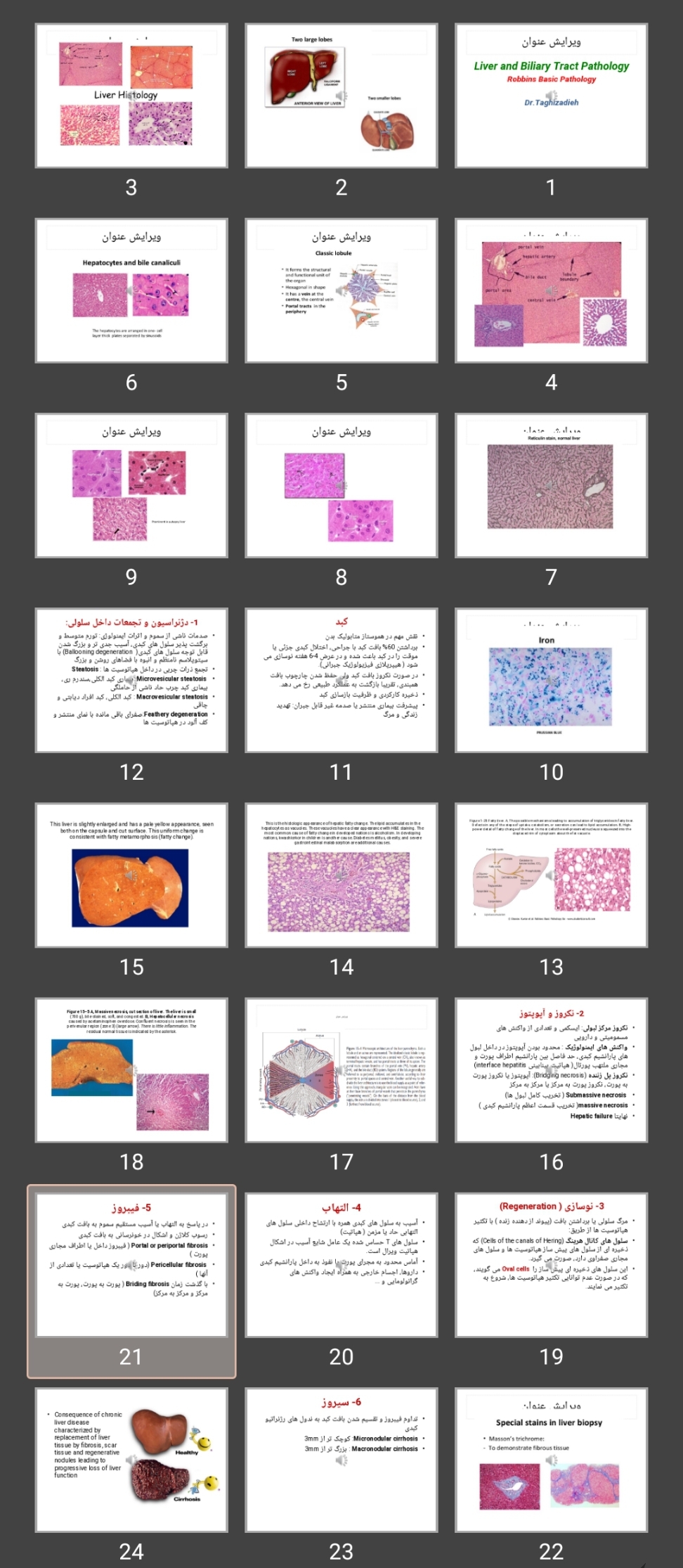 پاورپوینت Liver and Biliary Tract Pathology