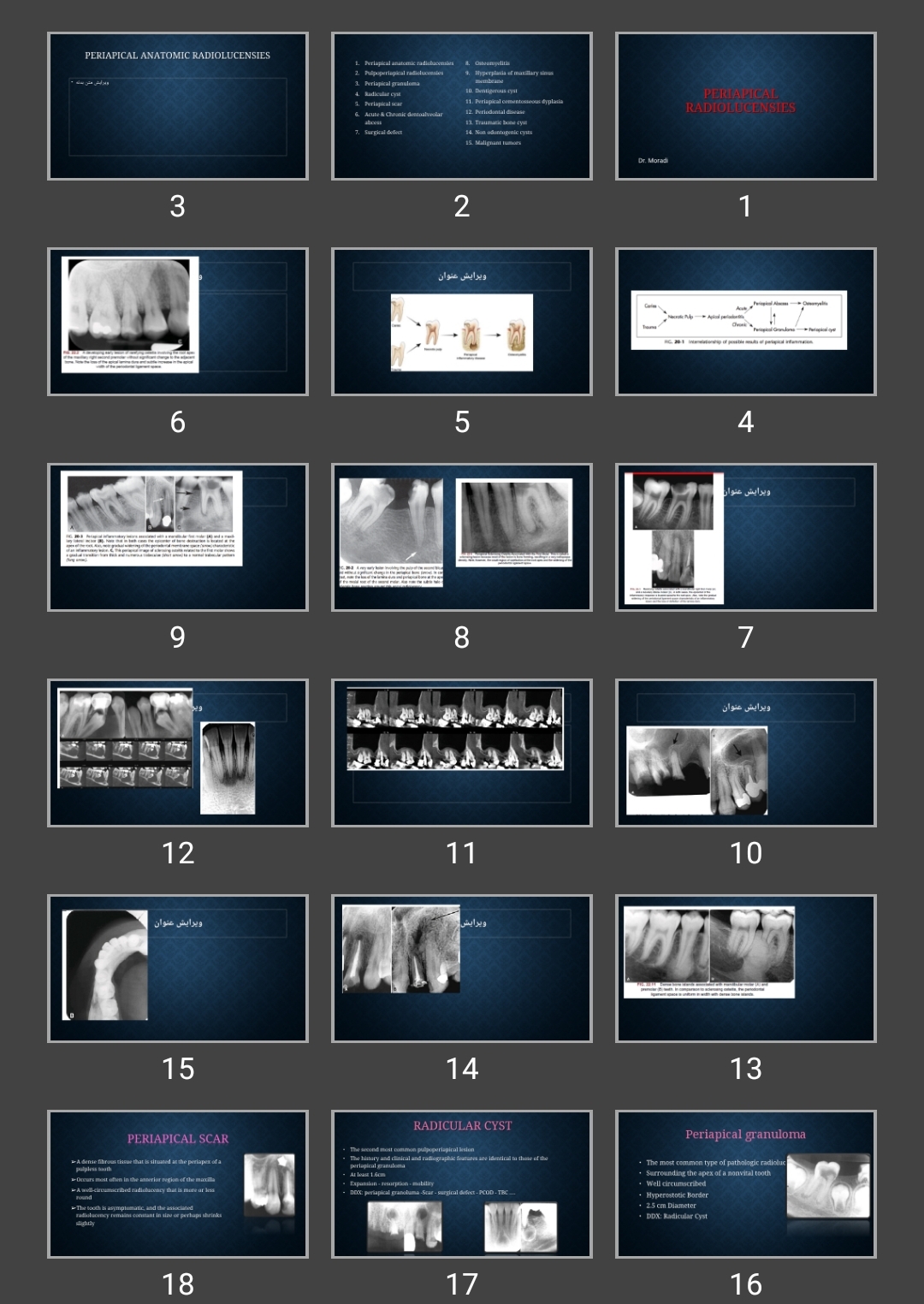 پاورپوینت Periapical radiolucensies