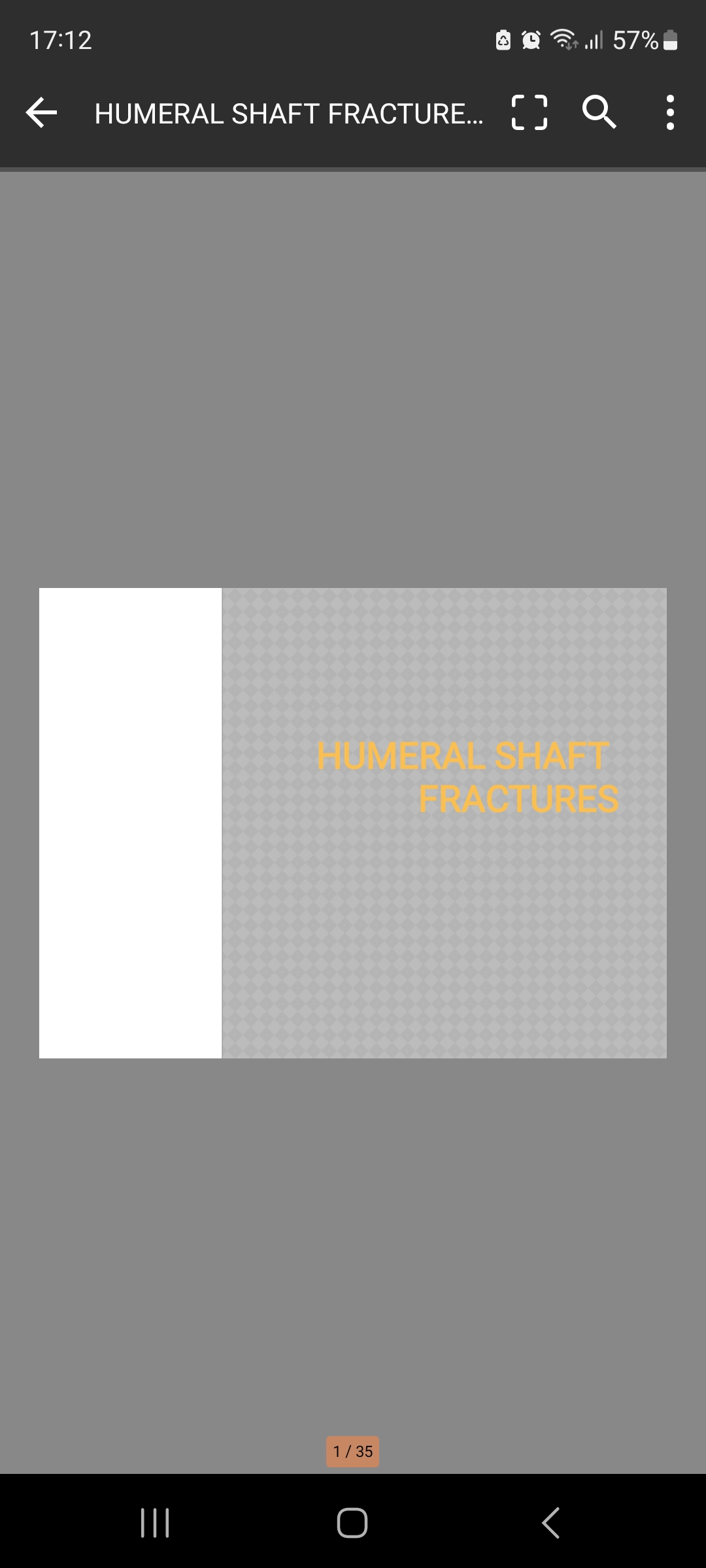 اسلاید شکستگی هومروس