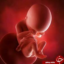 پاورپوینت , پره آ کلا مپسی و آکلامپسی حاملگی , 44 اسلاید , pptx