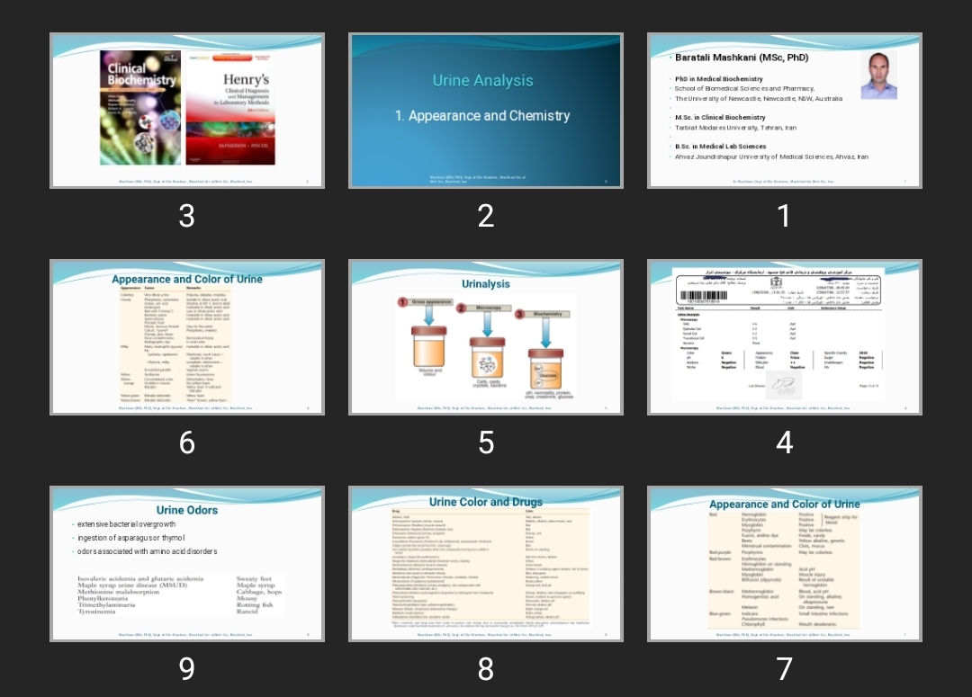 پاورپوینت Urine Alalysis Chemistry