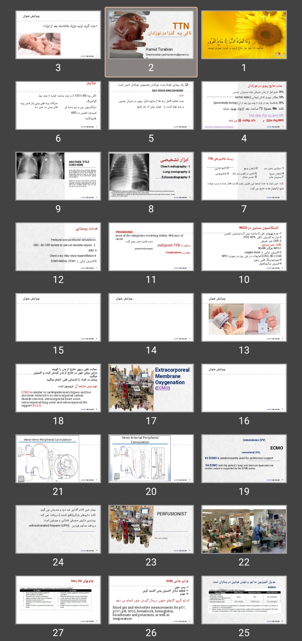 پاورپوینت TTN تاکی پنه  گذرا در نوزادان