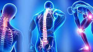   فایل fibromyalgia
