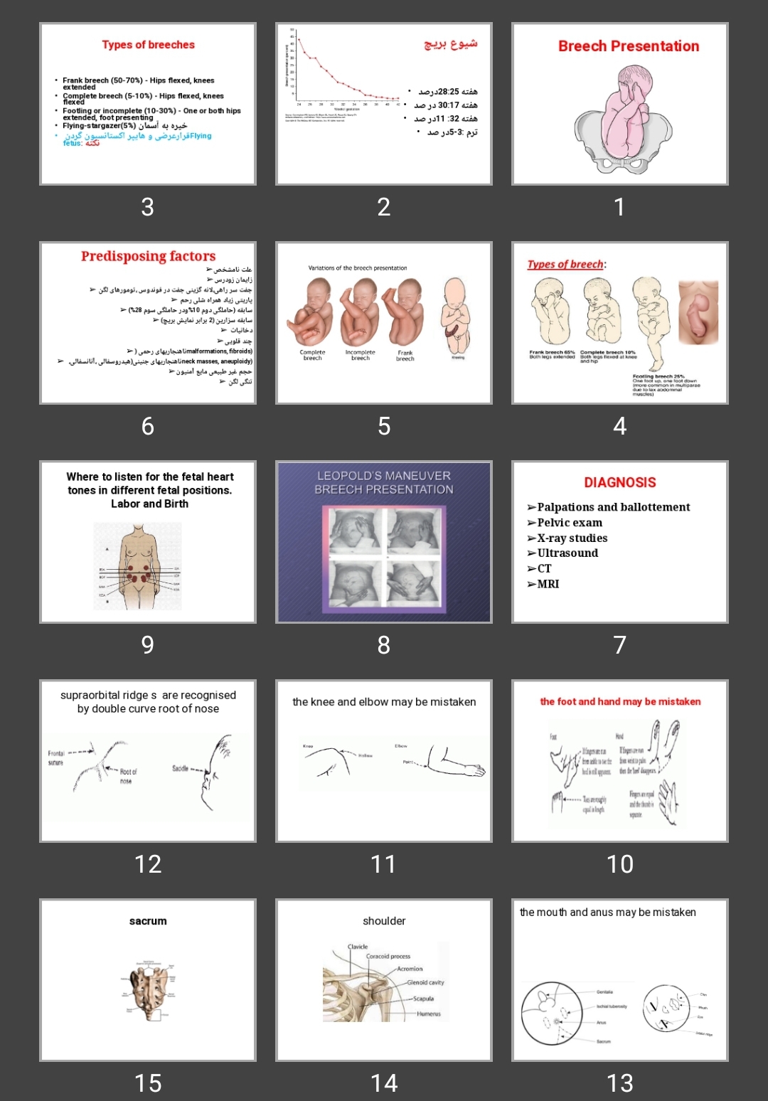 پاورپوینت بریچ (Breech Presentation)