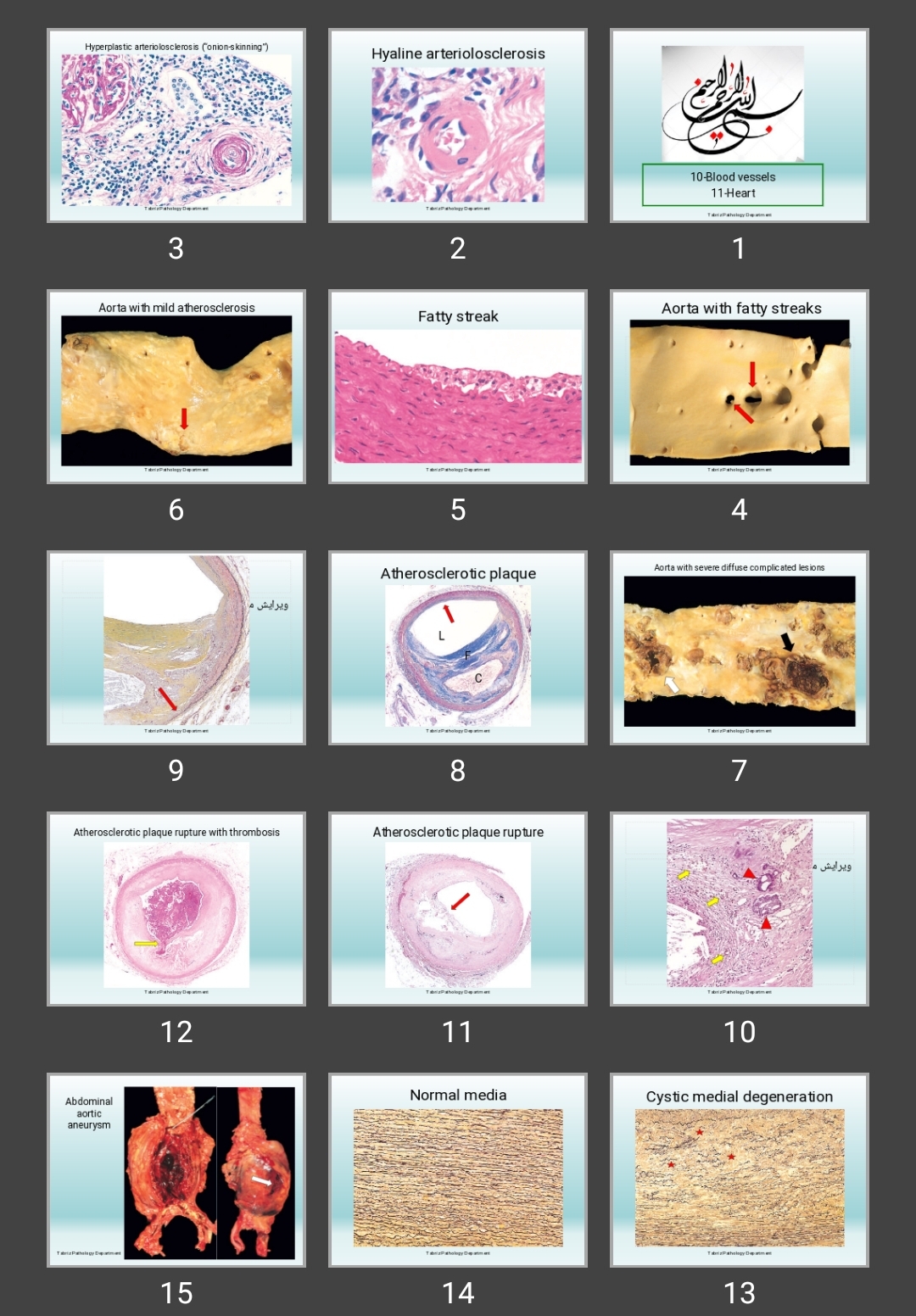 پاورپوینت Blood vessels