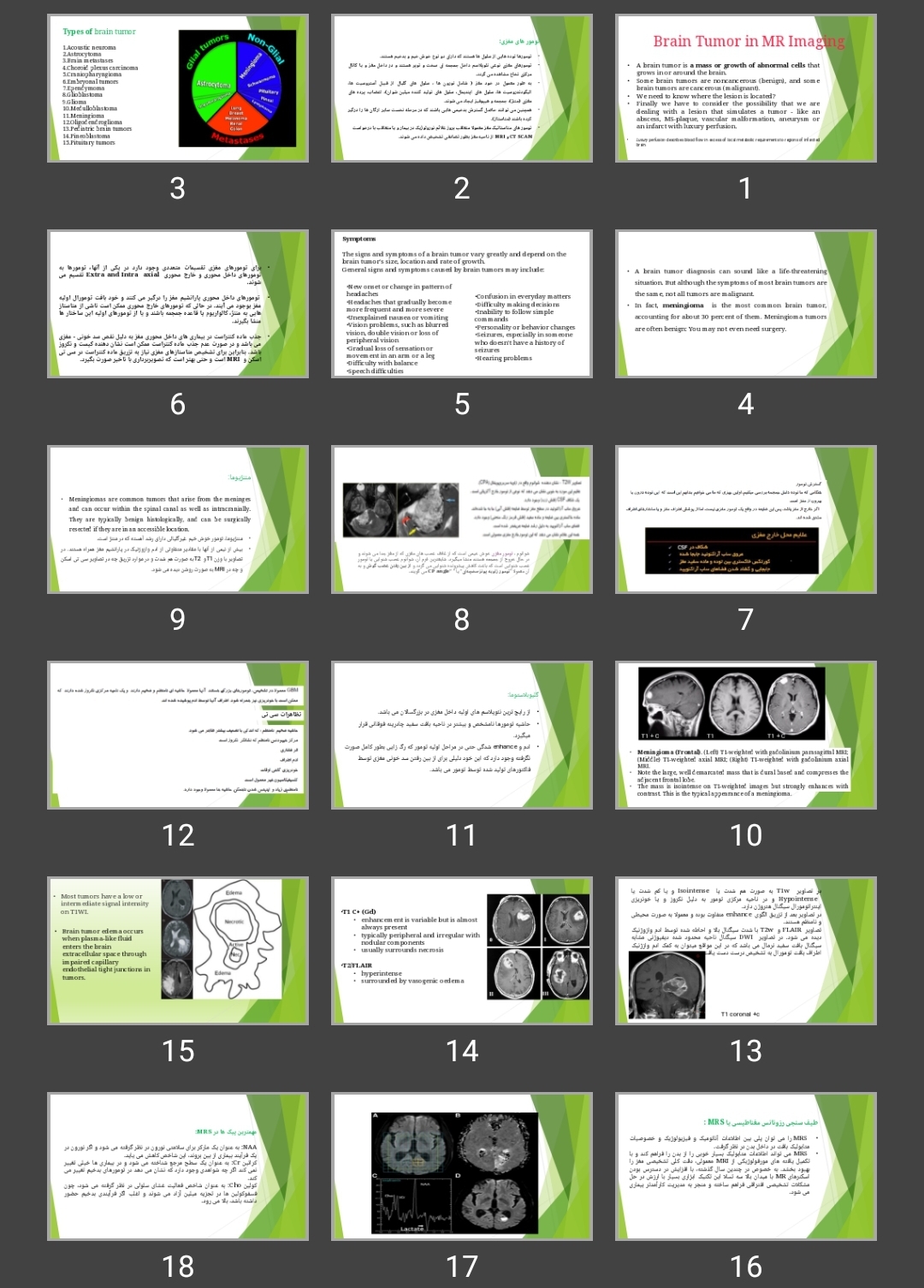 پاورپوینت تومور مغزی در mri