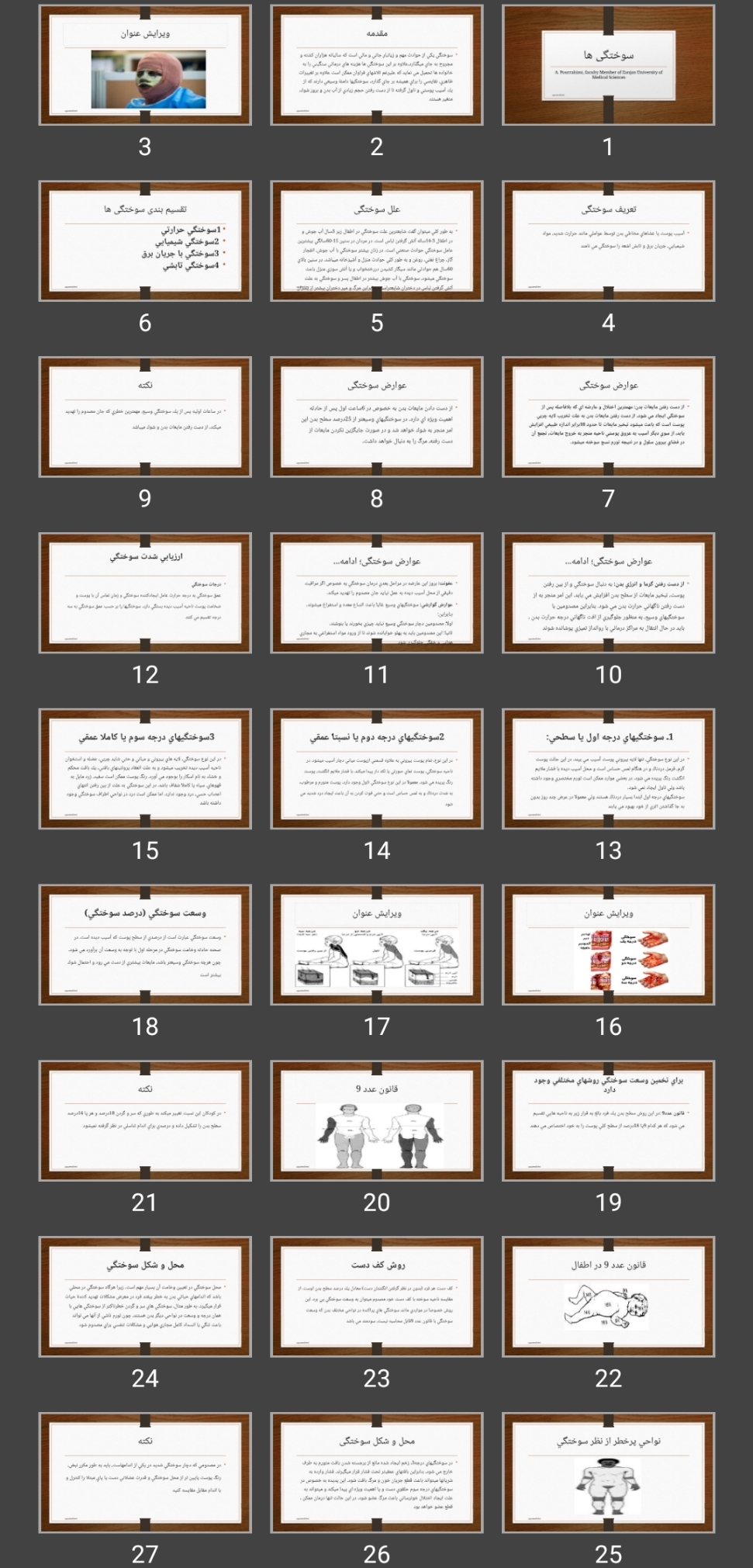 پاورپوینت سوختگی ها