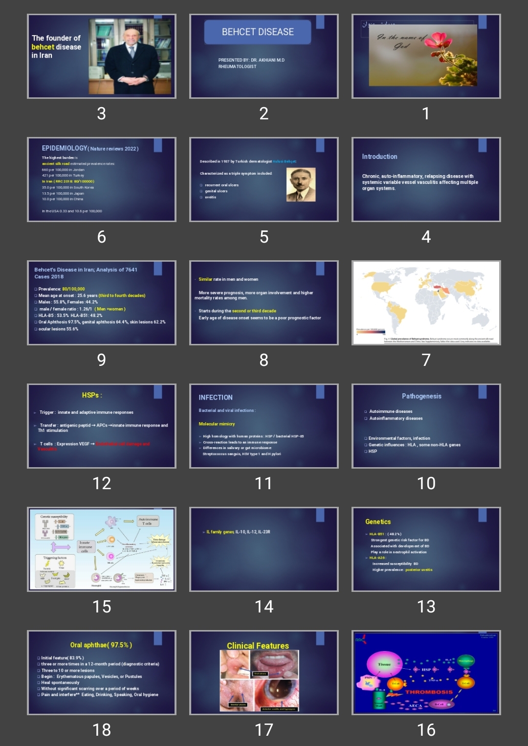 پاورپوینت BEHCET DISEASE