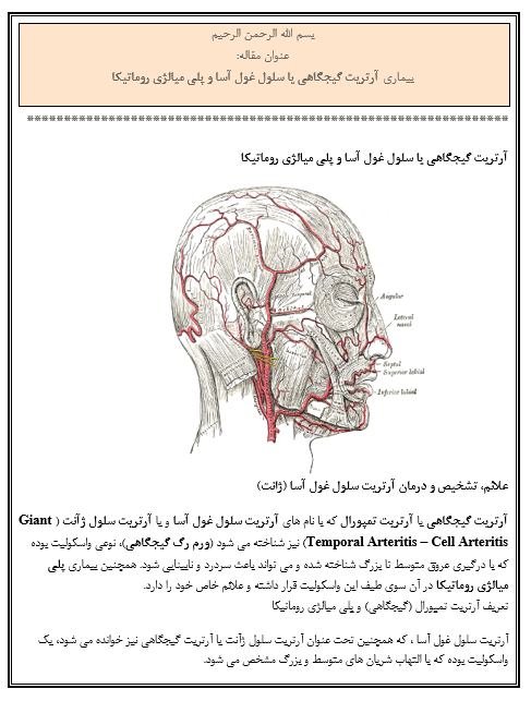 مقاله بیماری آرتریت گیجگاهی یا سلول غول آسا و پلی میالژی روماتیکا