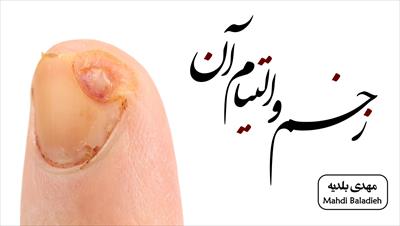 پاورپوینت فصل ترمیم زخم لارنس ۲۰۱۹