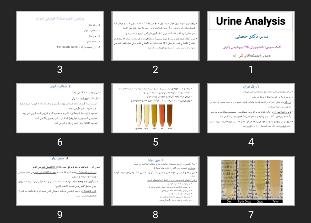 پاورپوینت Urine Analysis
