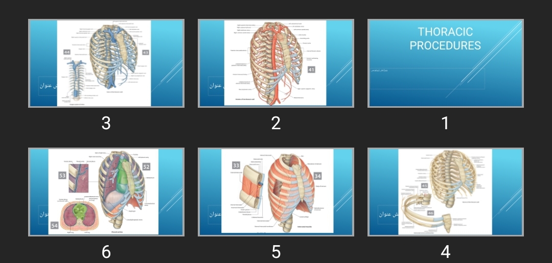 پاورپوینت THORACIC PROCEDURES