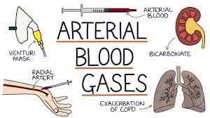 Arterial Blood Gas(گاز خون شریانی)