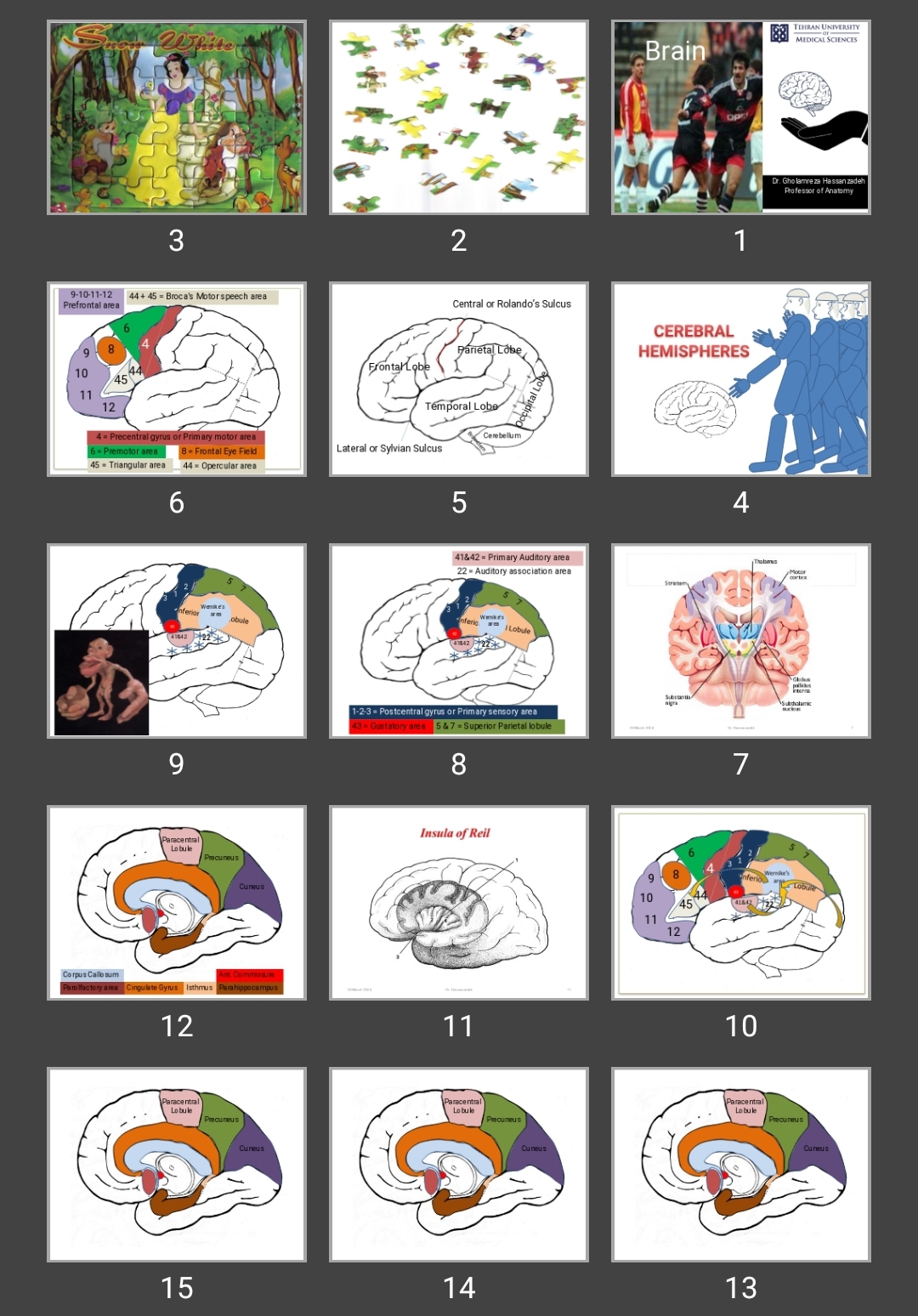 پاورپوینت Brain