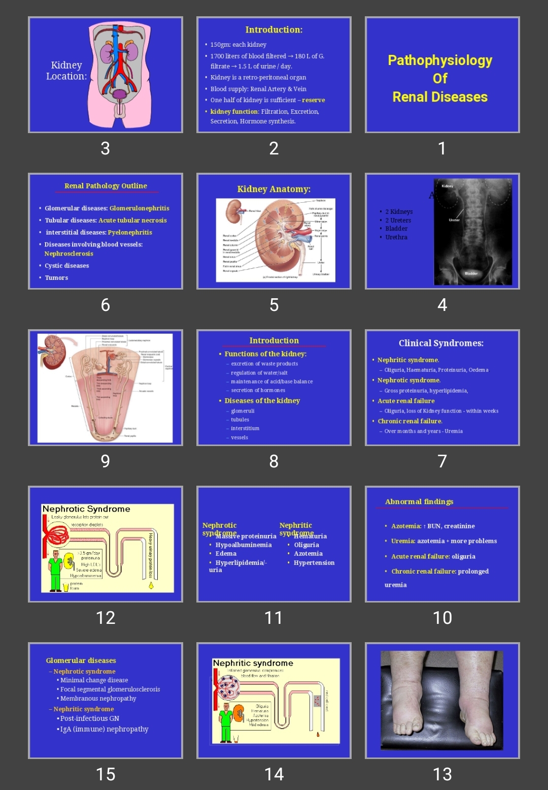 پاورپوینت Pathophysiology Of Renal Diseases