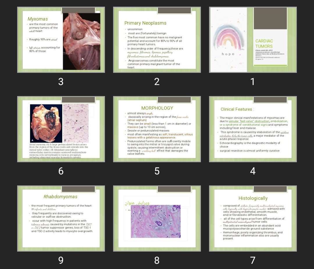 پاورپوینت CARDIAC TUMORS