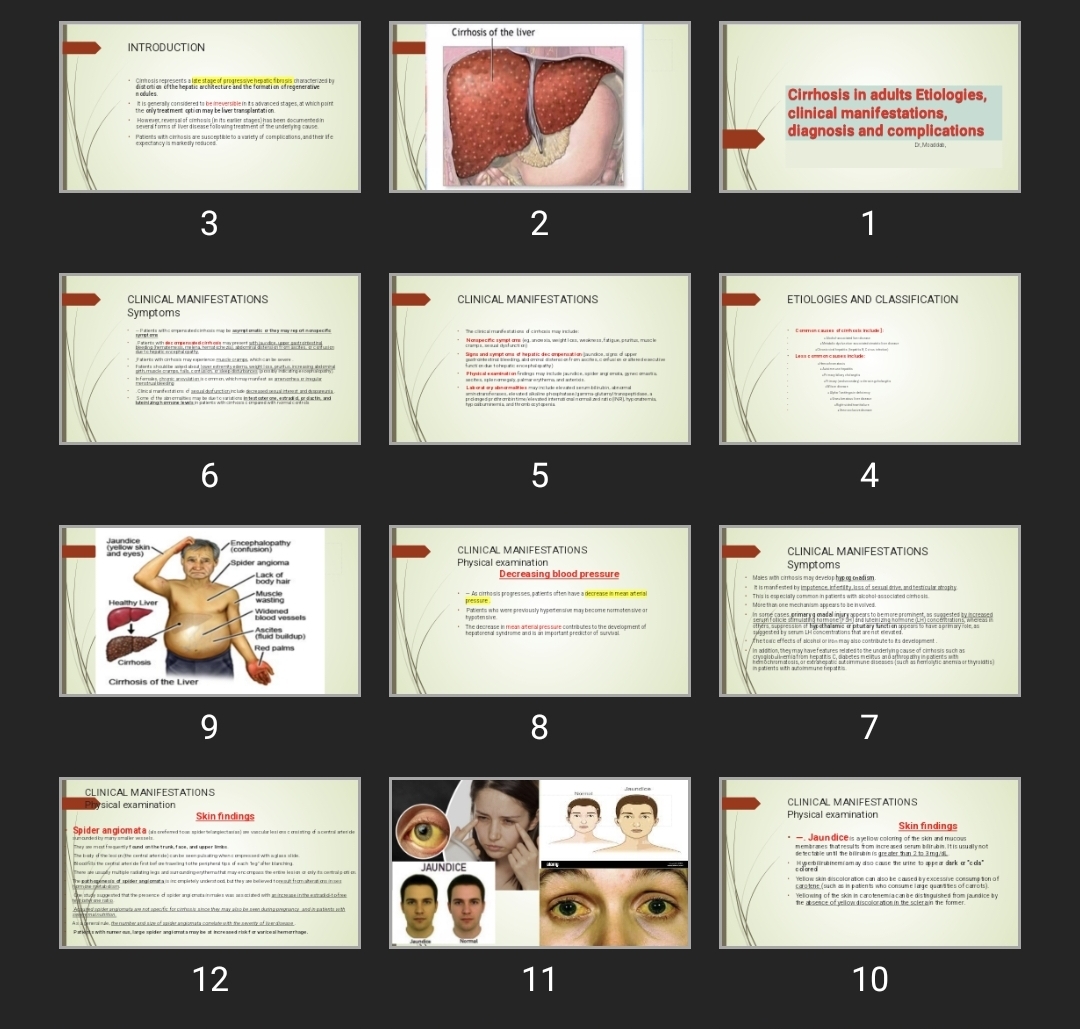 پاورپوینت Cirrhosis in adults Etiologies, clinical manifestations, diagnosis and complications