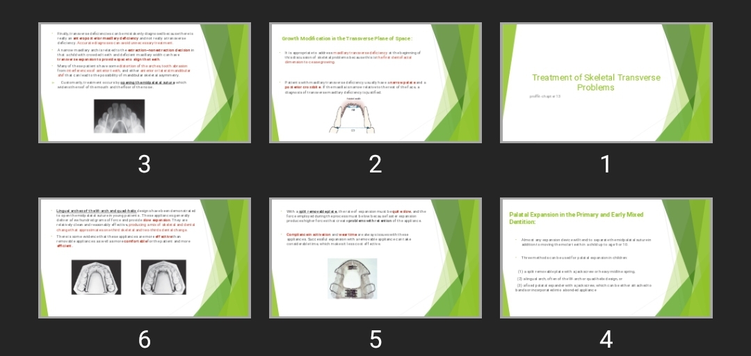 پاورپوینت Treatment of Skeletal Transverse Problems