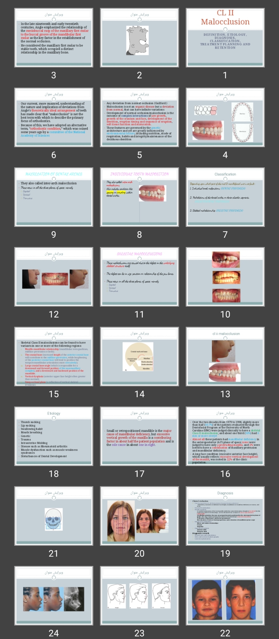 پاورپوینت CL II Malocclusion