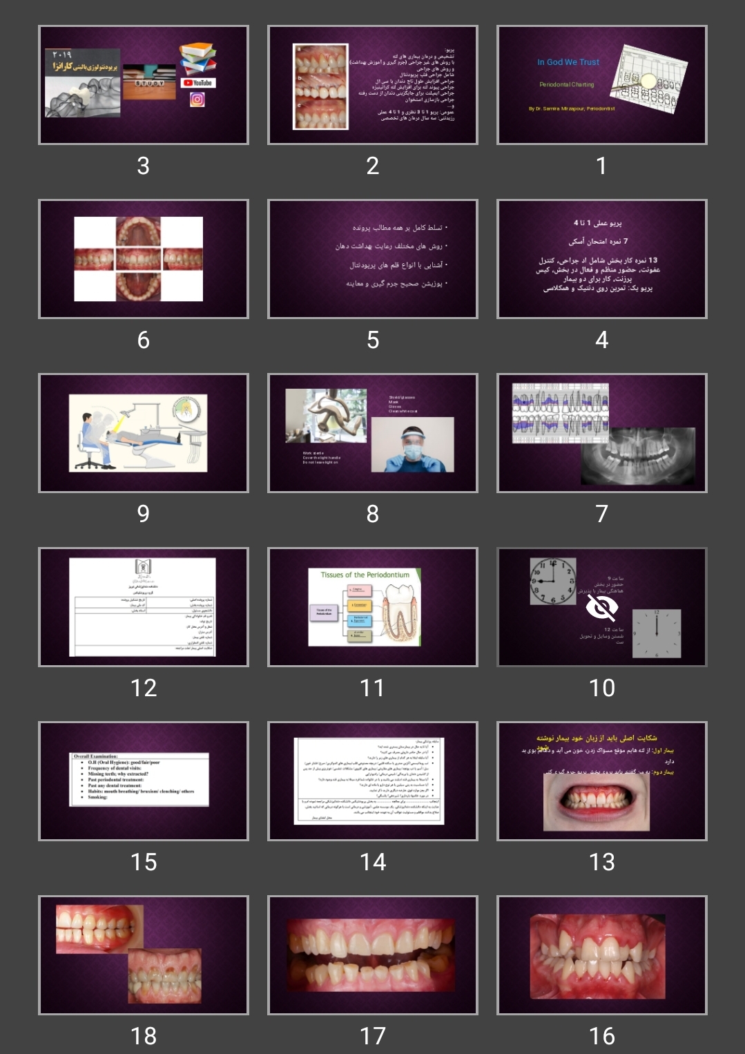 پاورپوینت پرونده پریو Periodontal Charting